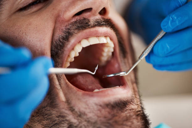 Best Broken or Chipped Tooth Repair in Van Wert, OH
