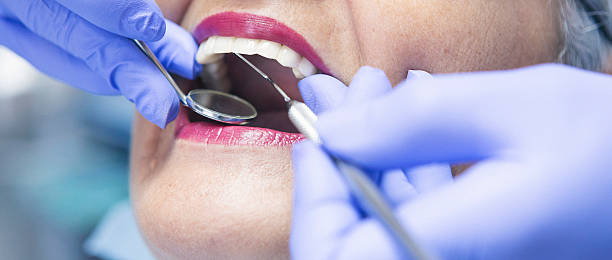 Best Knocked-Out Tooth (Avulsed Tooth) Treatment in Van Wert, OH